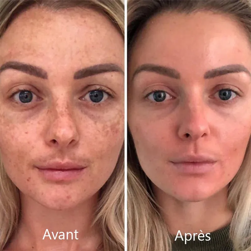 Crème éclaircissante pour les taches - Image 9