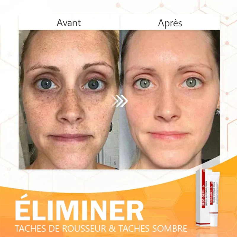 Crème éclaircissante pour les taches