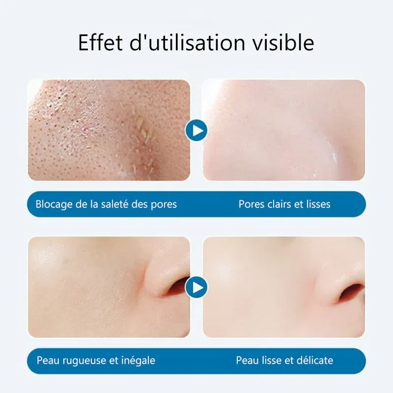 Sérum nettoyant en profondeur aux bulles d'oligopeptides - Image 4