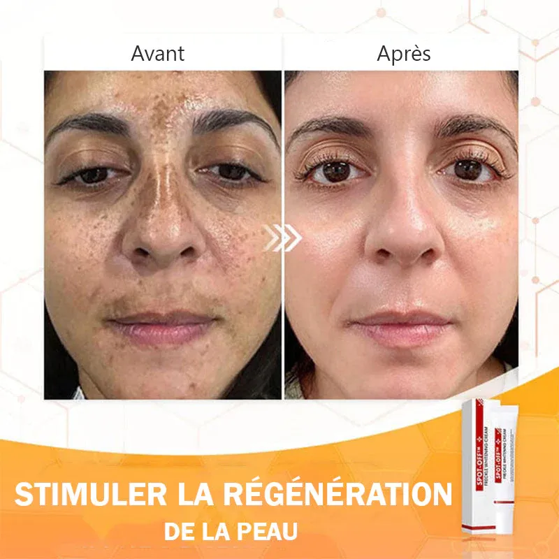 Crème éclaircissante pour les taches - Image 3