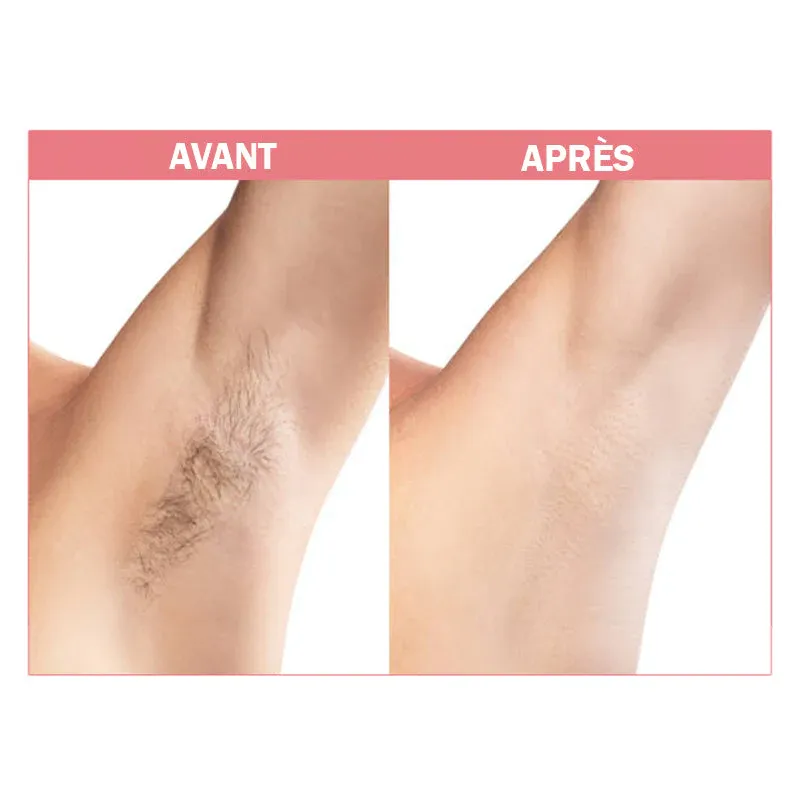 Mousse dépilatoire à la cire d'abeille - Image 4