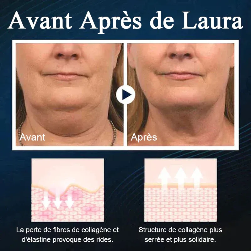 Appareil de beauté du visage en V endormi - Image 4