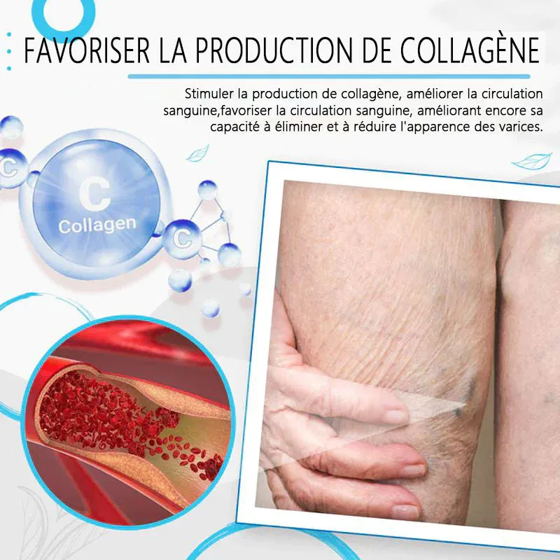 Crème de traitement des varices - Image 5