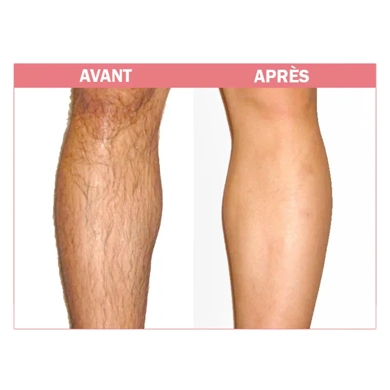 Mousse dépilatoire à la cire d'abeille - Image 7