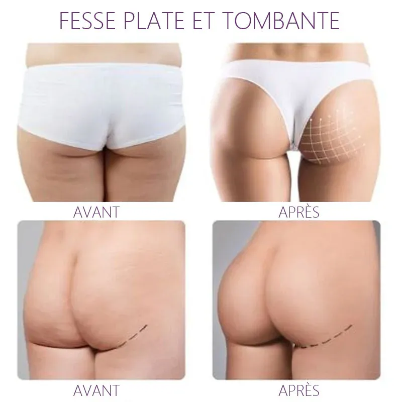 Huile essentielle bio Instantanée lifting des hanches - Image 5