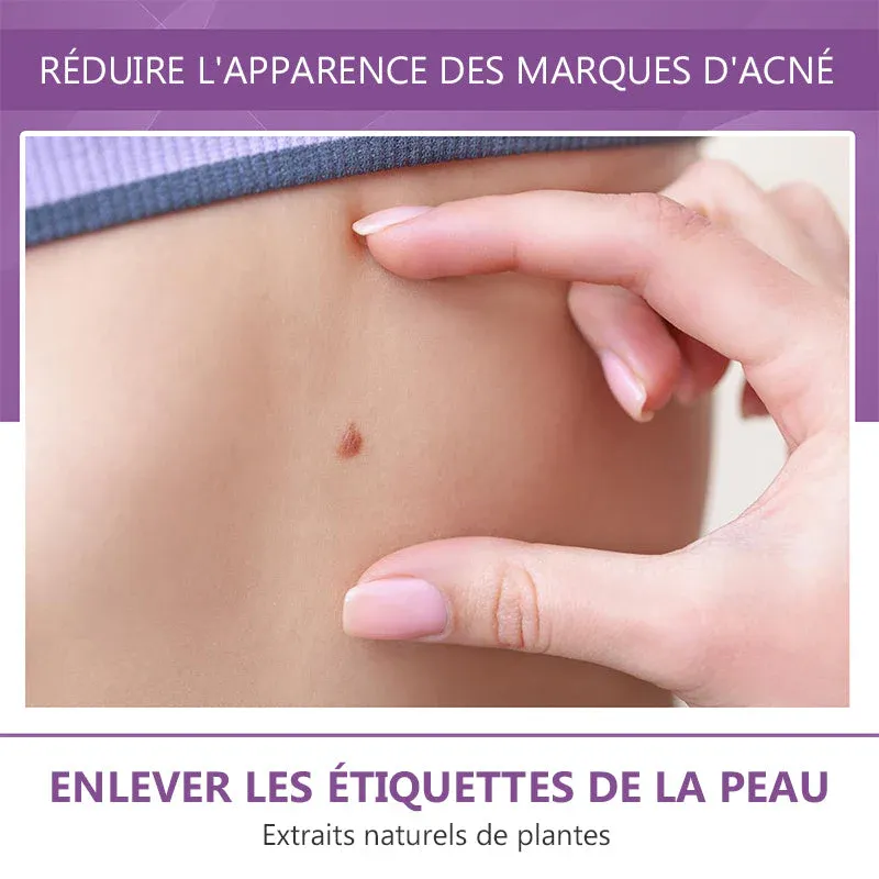 Stylo anti-acrochordons retirer des étiquettes de peau (2 pièces) - Image 5