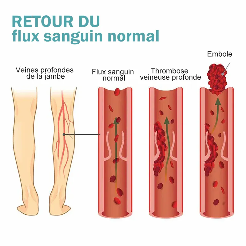 Genouillères auto-chauffantes à acupression en graphène - Image 5