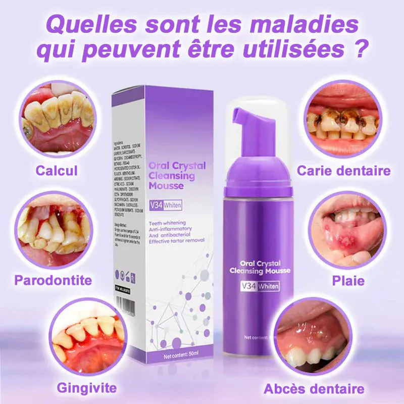 Mousse pour nettoyer les dents - Image 5