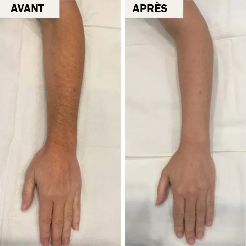 Mousse dépilatoire à la cire d'abeille - Image 6