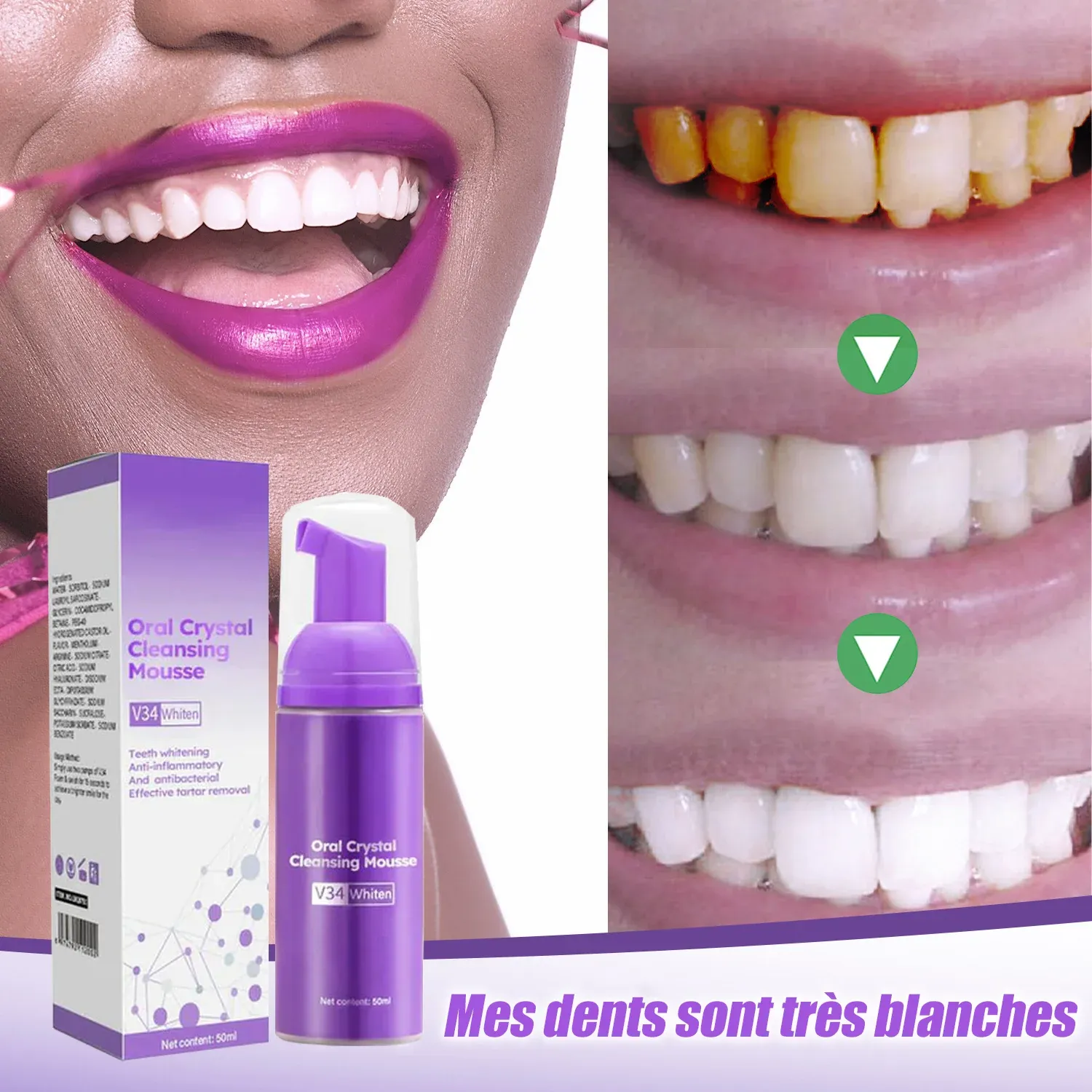 Mousse pour nettoyer les dents - Image 4