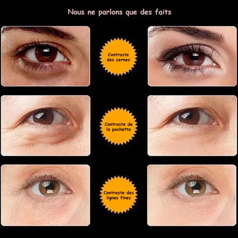 Crème des yeux anti-rides atténuer les ridules - Image 7